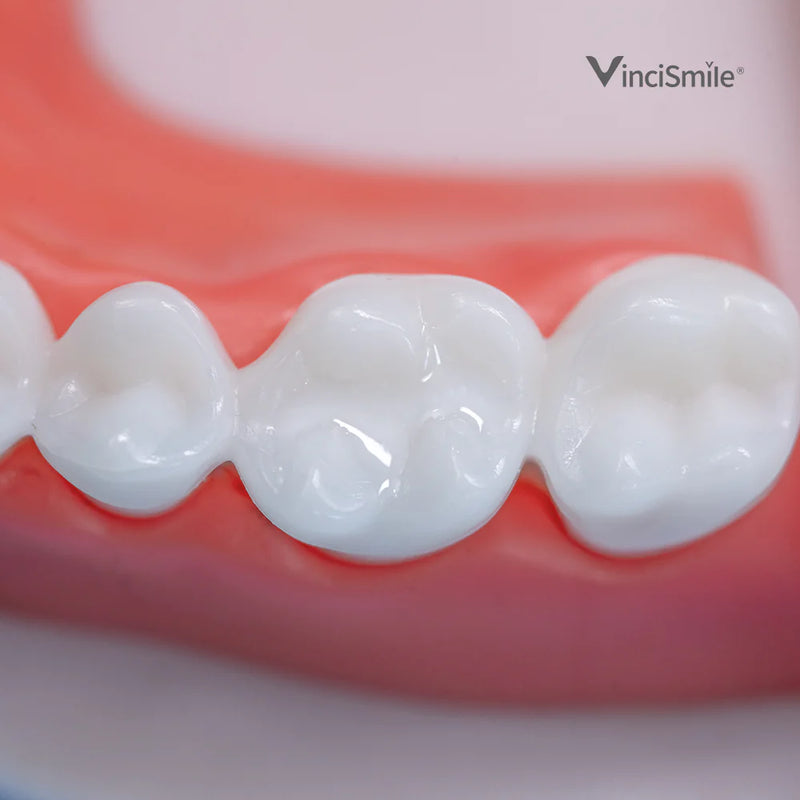 Proseal F Enamel Coating Resin x1 seringue - VINCISMILE  - Safe Implant