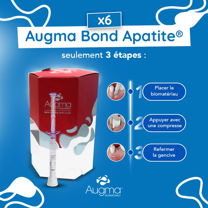 boite 6x Bond Apatite™ comblement osseux instantané par Augma Biomaterials™ - Safe Implant