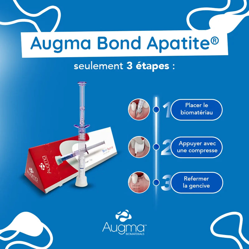 Bond Apatite™ comblement osseux instantané par Augma Biomaterials™