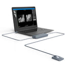 Capteur intra-oral X-ray sensor - XPECT VISION - Safe Implant