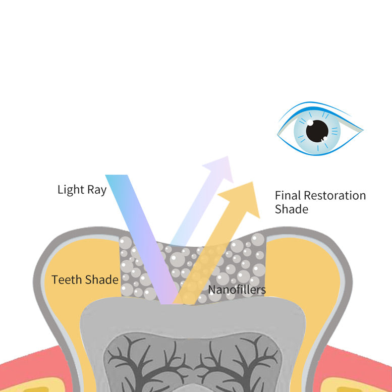 Mimétisme - TrusFIL X-Blend 4g - VinciSmile - Safe Implant