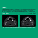 Système d’imagerie 4-en-1 3D / 2D - Green 2 - Vatech - Safe Implant