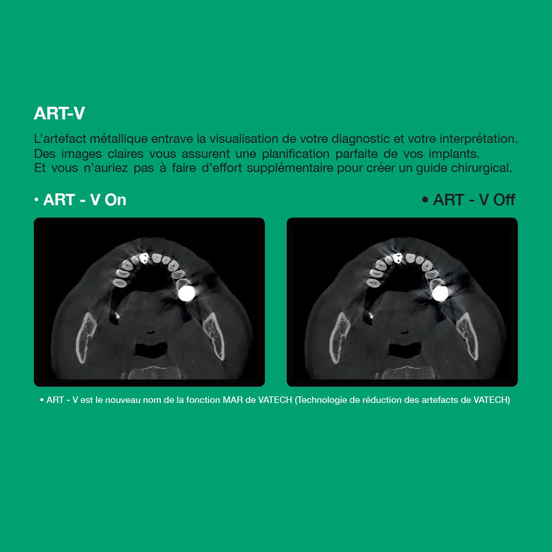 Système d’imagerie 4-en-1 3D / 2D - Green 2 - Vatech - Safe Implant