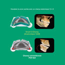 Système d’imagerie panoramique 3D / 2D - Smart 2 - Vatech - Safe Implant