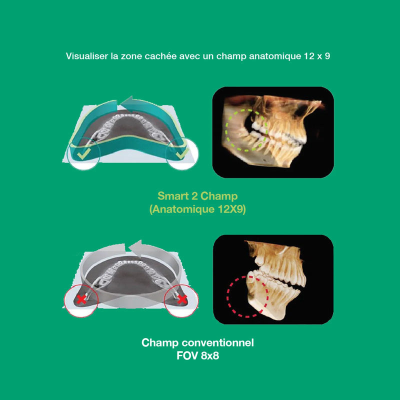 Système d’imagerie panoramique 3D / 2D - Smart 2 - Vatech - Safe Implant