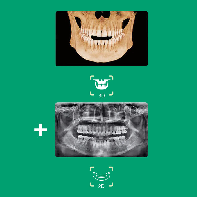 Système d’imagerie panoramique 3D / 2D - Smart 2 - Vatech - Safe Implant