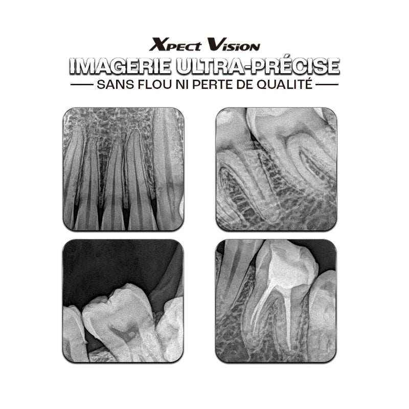 Capteur intra-oral X-ray sensor - XPECT VISION - Safe Implant