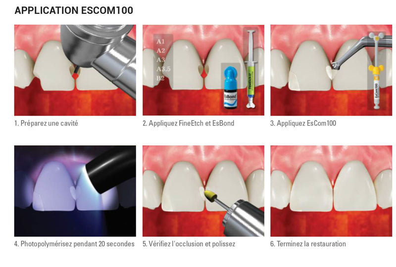 Lot de 20 capsules de 0,25g EsCom100 - B2 - Résine composite nano-hybride restauratrice photopolymérisable - Safe Implant