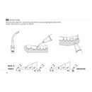 Insert G6 compatible EMS ultrarésistant UR - WOODPECKER - Safe Implant