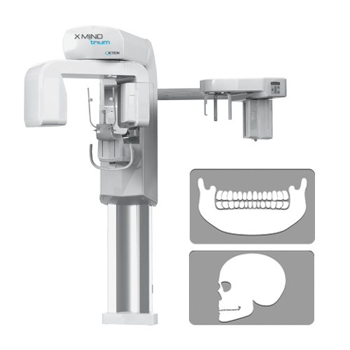 Imagerie extra-orale X-Mind trium Pan Ceph - ACTEON - Safe Implant