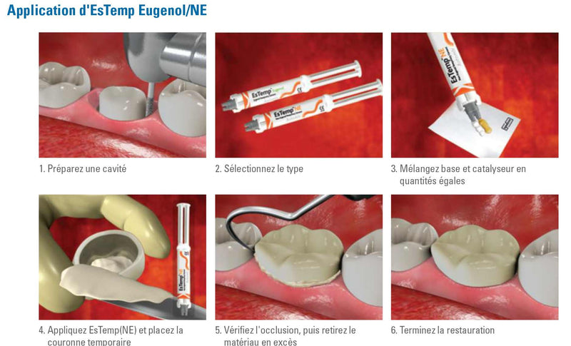 EsTemp NE 2x 10g Ciment temporaire pour couronnes et bridges temporaires - Safe Implant