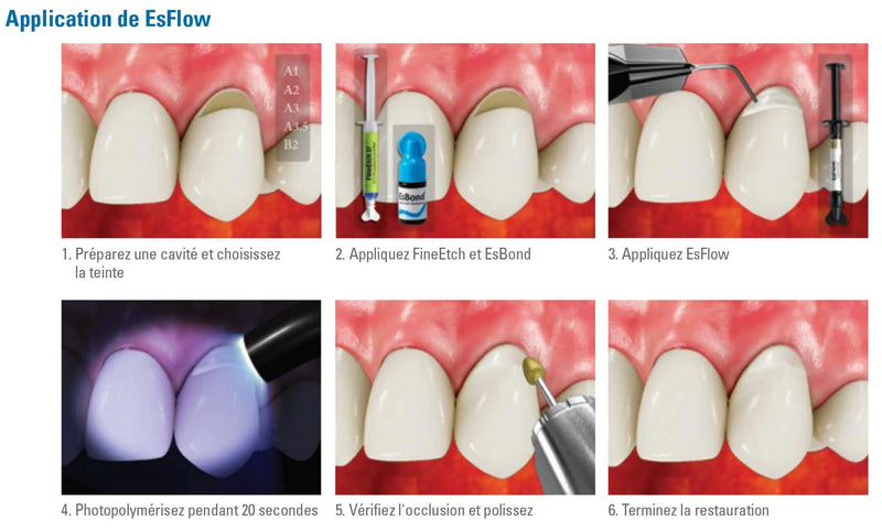 Es Flow A2 (2 seringues x 2g Résine composite fluide photopolymérisable) - Safe Implant