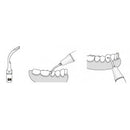 Insert GD6 compatible Satelec ultrarésistant UR - WOODPECKER - Safe Implant